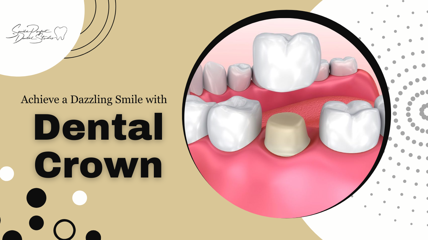 Dental Crown in Hialeah, FL